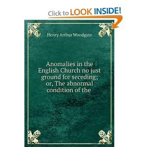  Anomalies in the English Church no just ground for seceding 