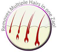 Espil BSL 10 Home IPL Hair Remover with Silkn Rio AUS  